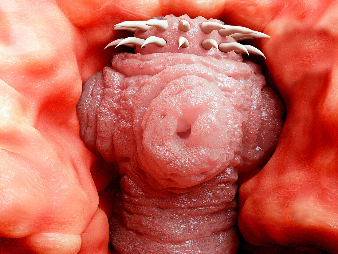 Tapeworm head attached to intestine, illustration