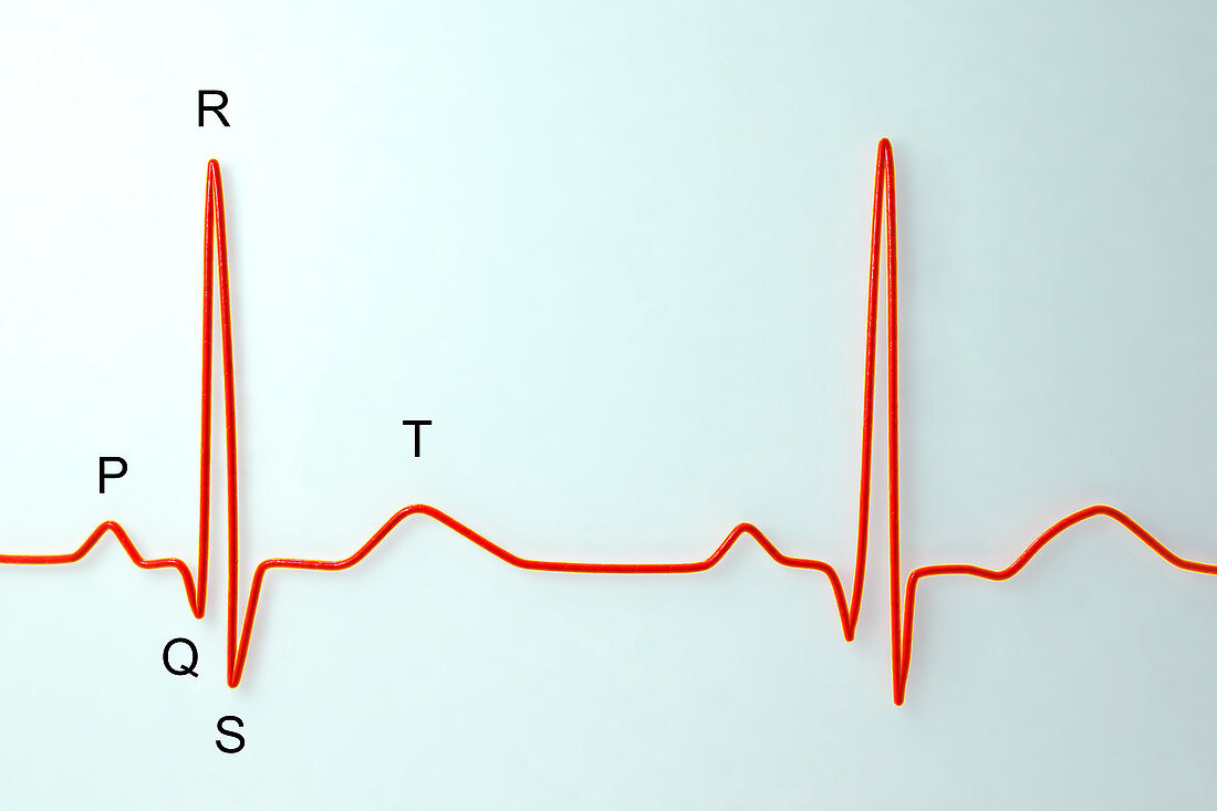 ECG, illustration