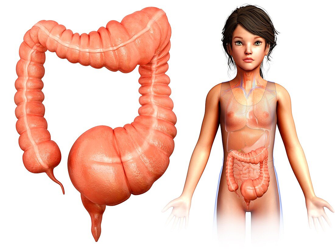 Child with mega colon, illustration