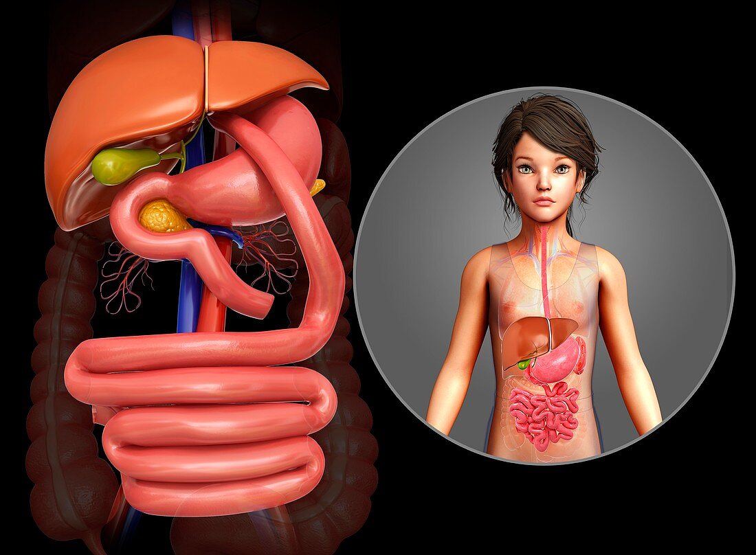 Gastric bypass, illustration