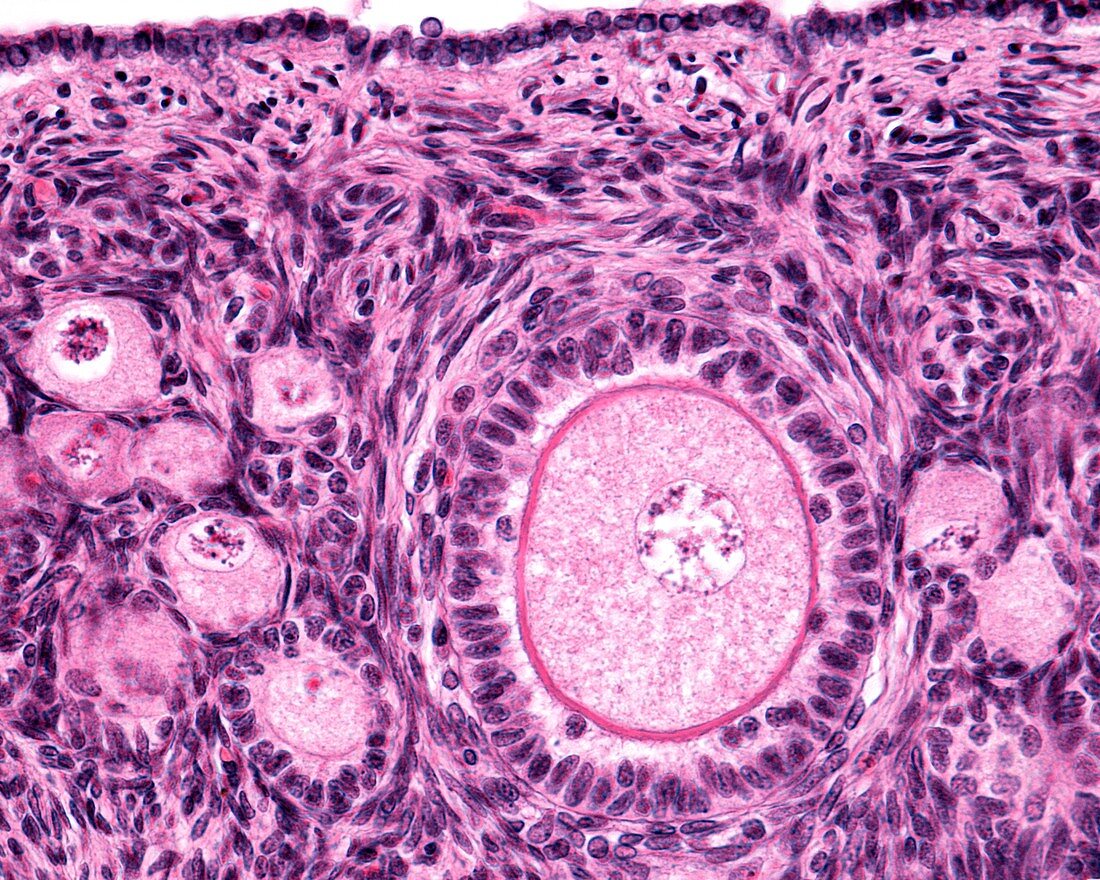 Ovarian primary follicle,light micrograph
