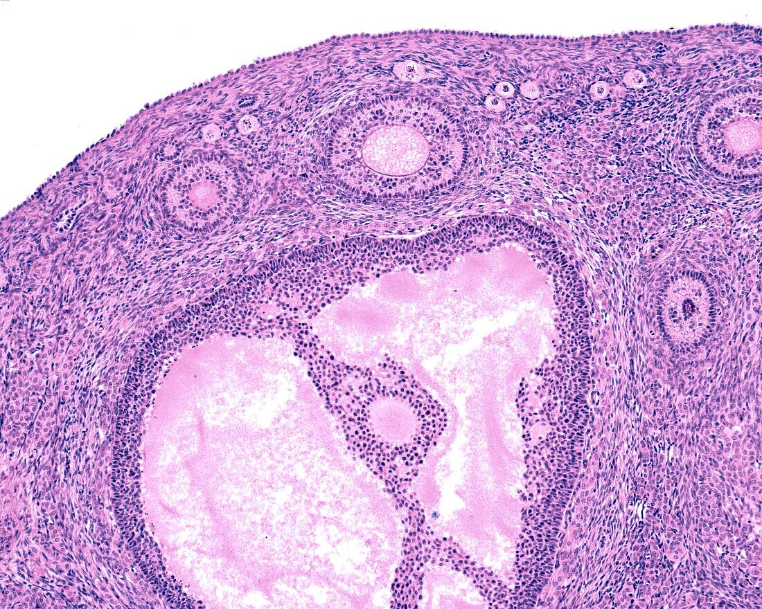 Ovarian tertiary follicle,light micrograph