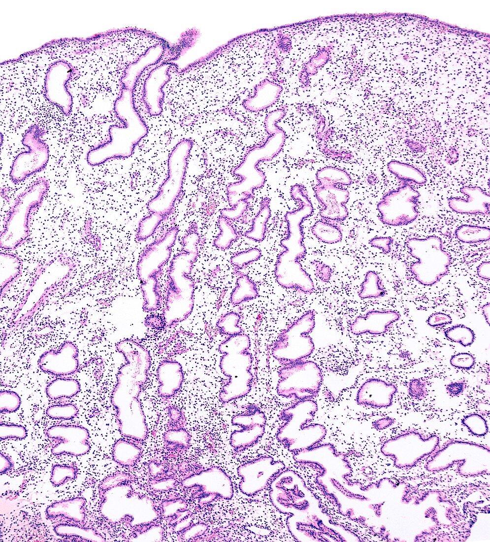 Endometrium in secretory phase,light micrograph