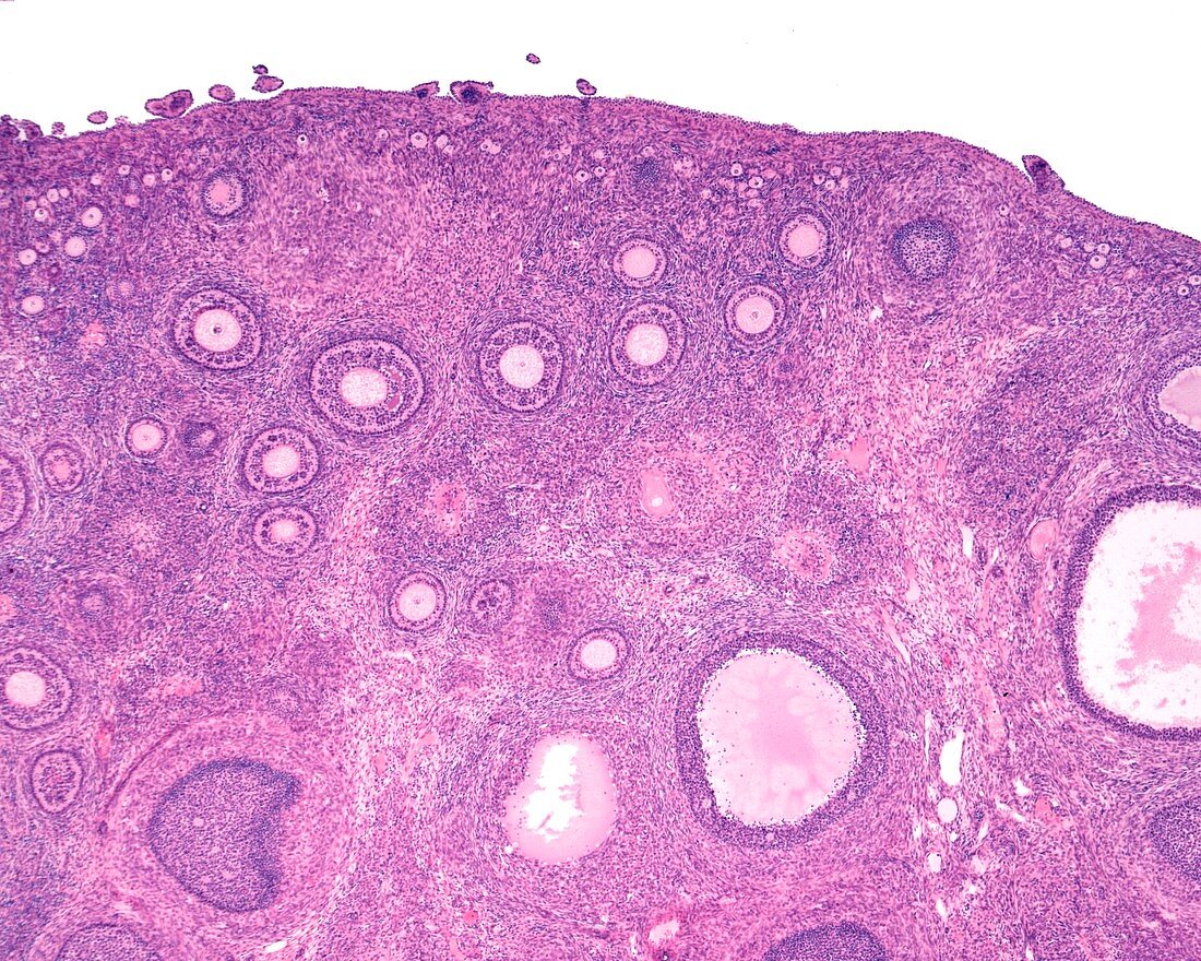 Ovarian follicles,light micrograph