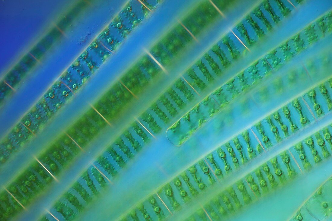 Algal strands,light micrograph