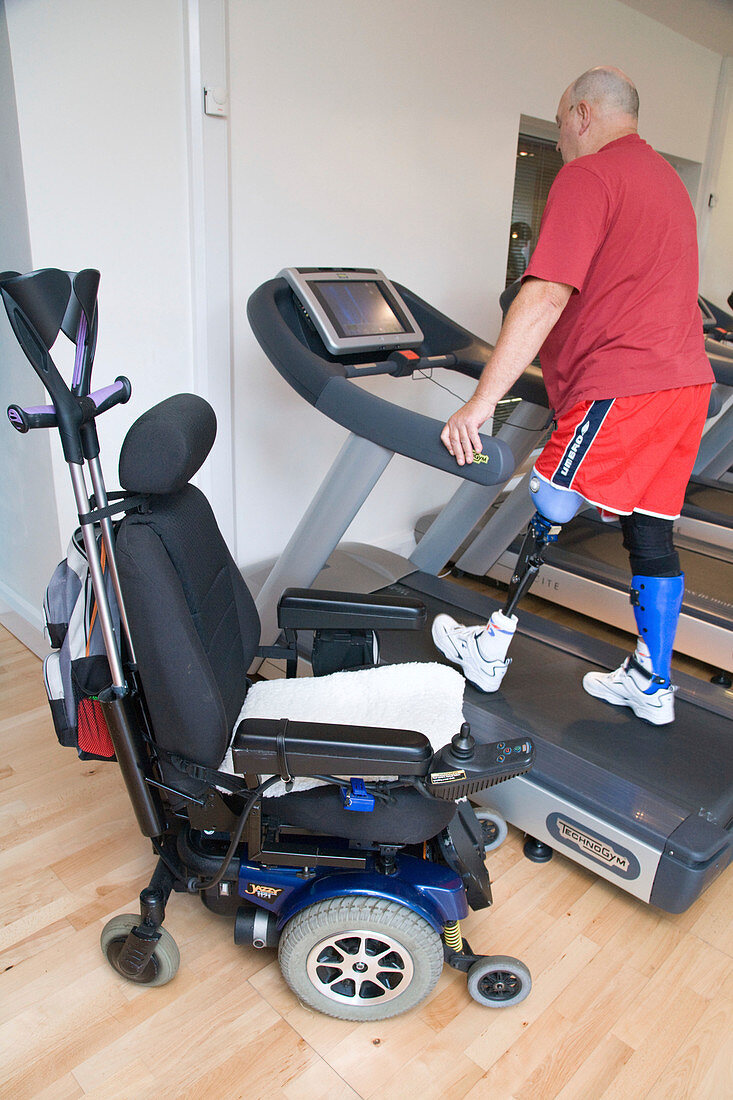 Man with prosthetic limb using a treadmill at the gym
