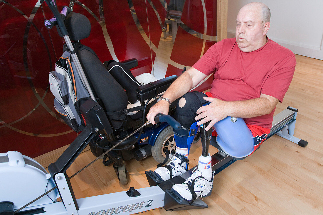Man with prosthetic limb using a rowing machine at the gym