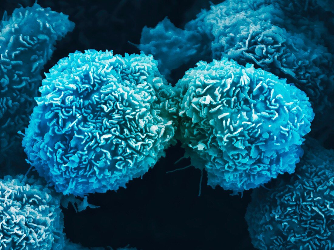 Pancreatic cancer cells,SEM
