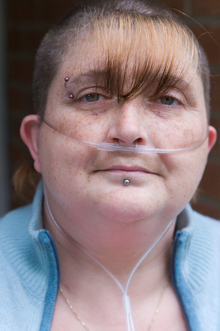 Portrait of woman who is severely asthmatic