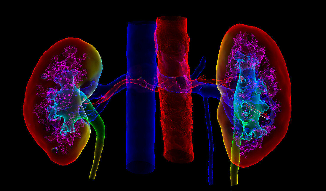 Kidneys and arteries and veins,3D MRI scan