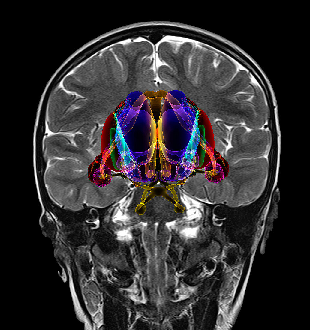 Human brain and limbic system,MRI-based illustration