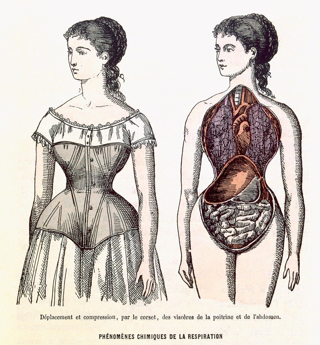 The Harmful Effects of the Corset, illustration