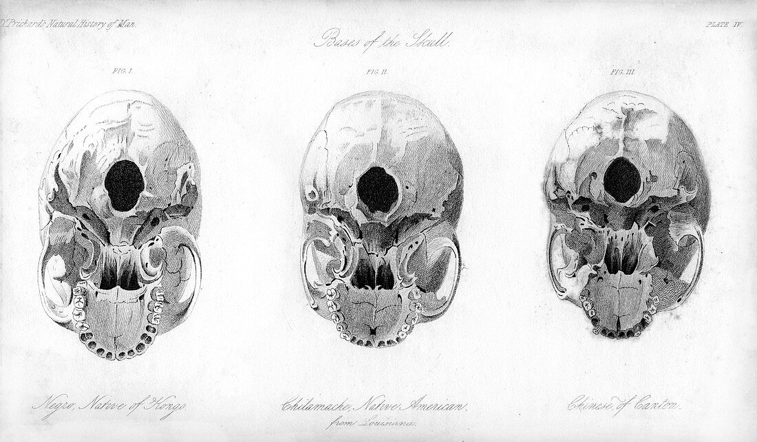 Base of the skull, 1848
