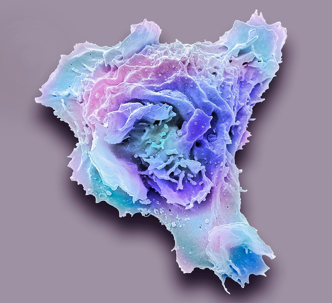 Leukaemia cell, SEM