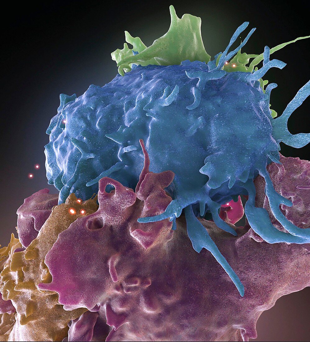 HIV-infected and uninfected cells, FIB-SEM image