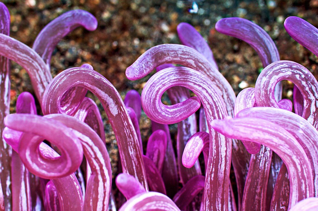 Cork-screw anemone