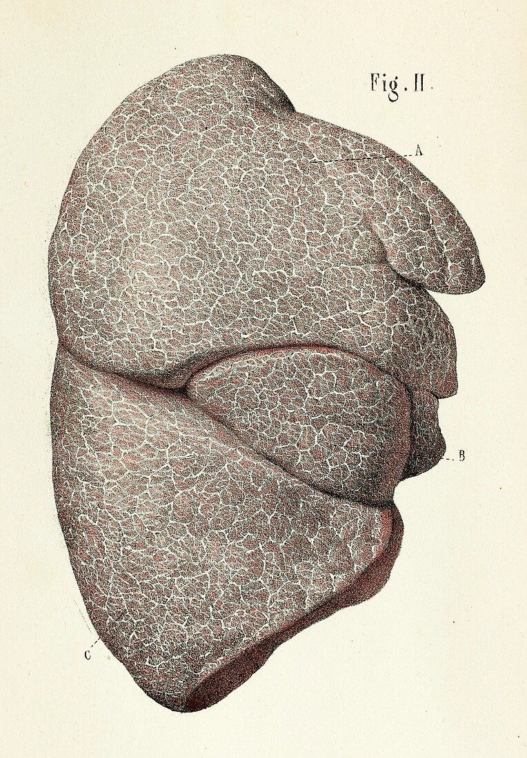 Lymphatic anatomy of the lungs, 1866 illustration