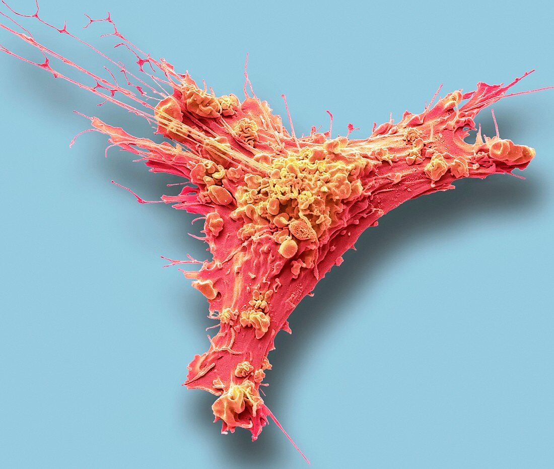 Fibroblast cell, SEM