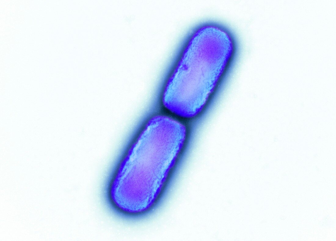 Kingella kingae bacteria, TEM