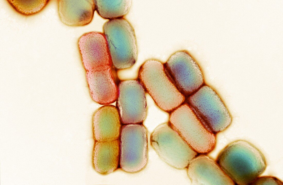 Kingella kingae bacteria, TEM