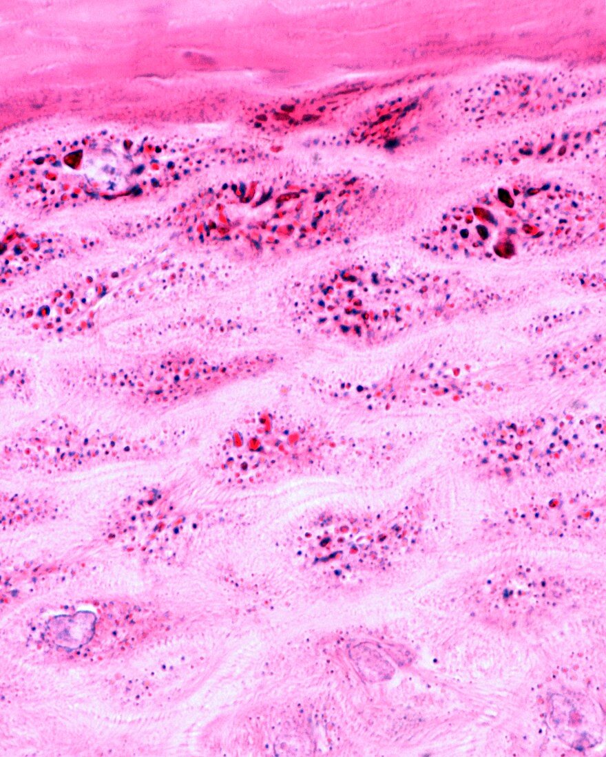 Granular layer of epidermis, light micrograph