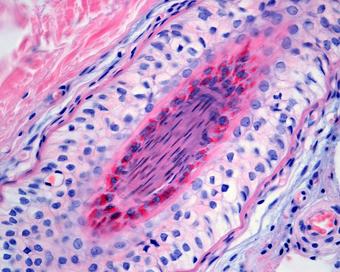 Hair follicle, light micrograph