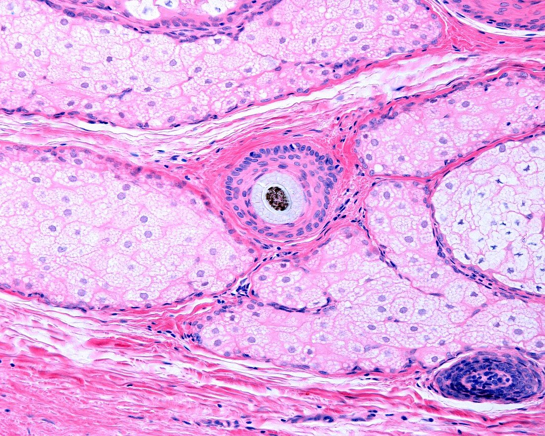 Pilosebaceous unit, light micrograph