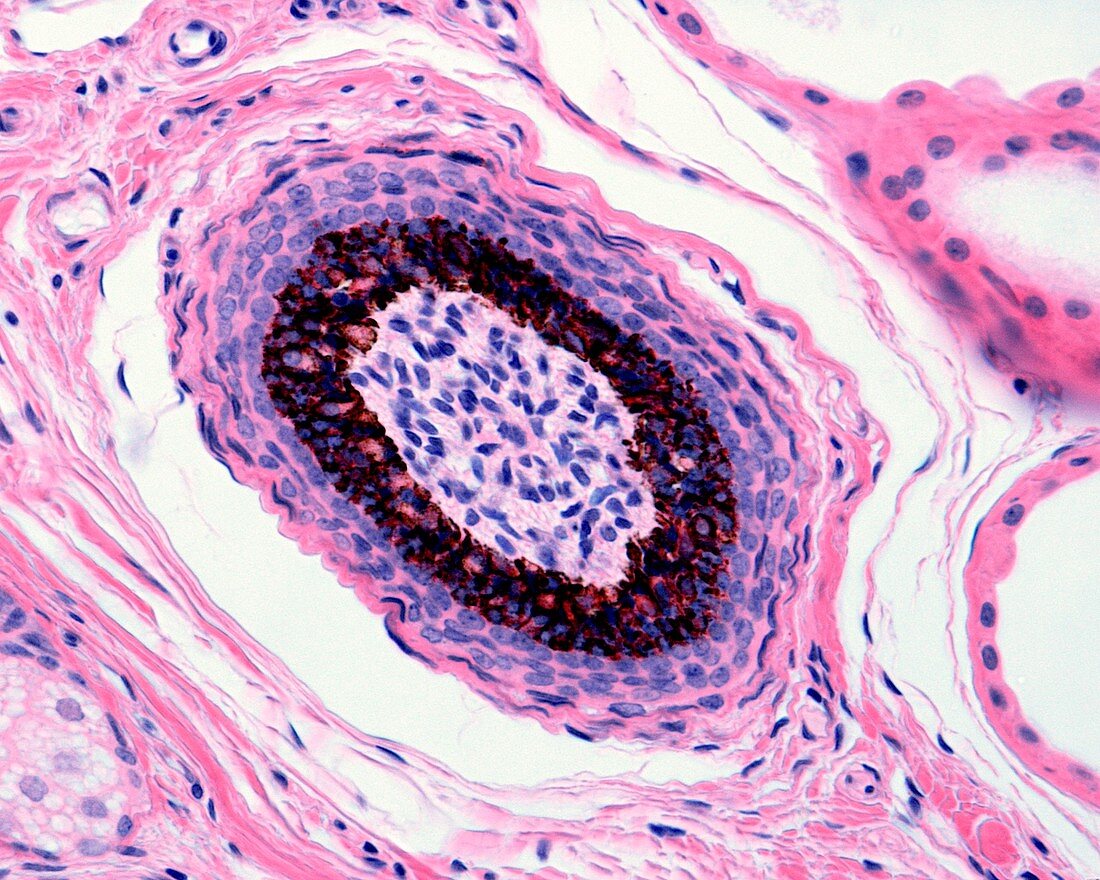 Hair follicle, light micrograph