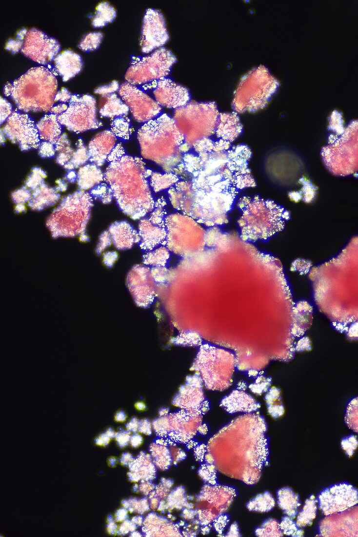 Microplastic particles, light micrograph