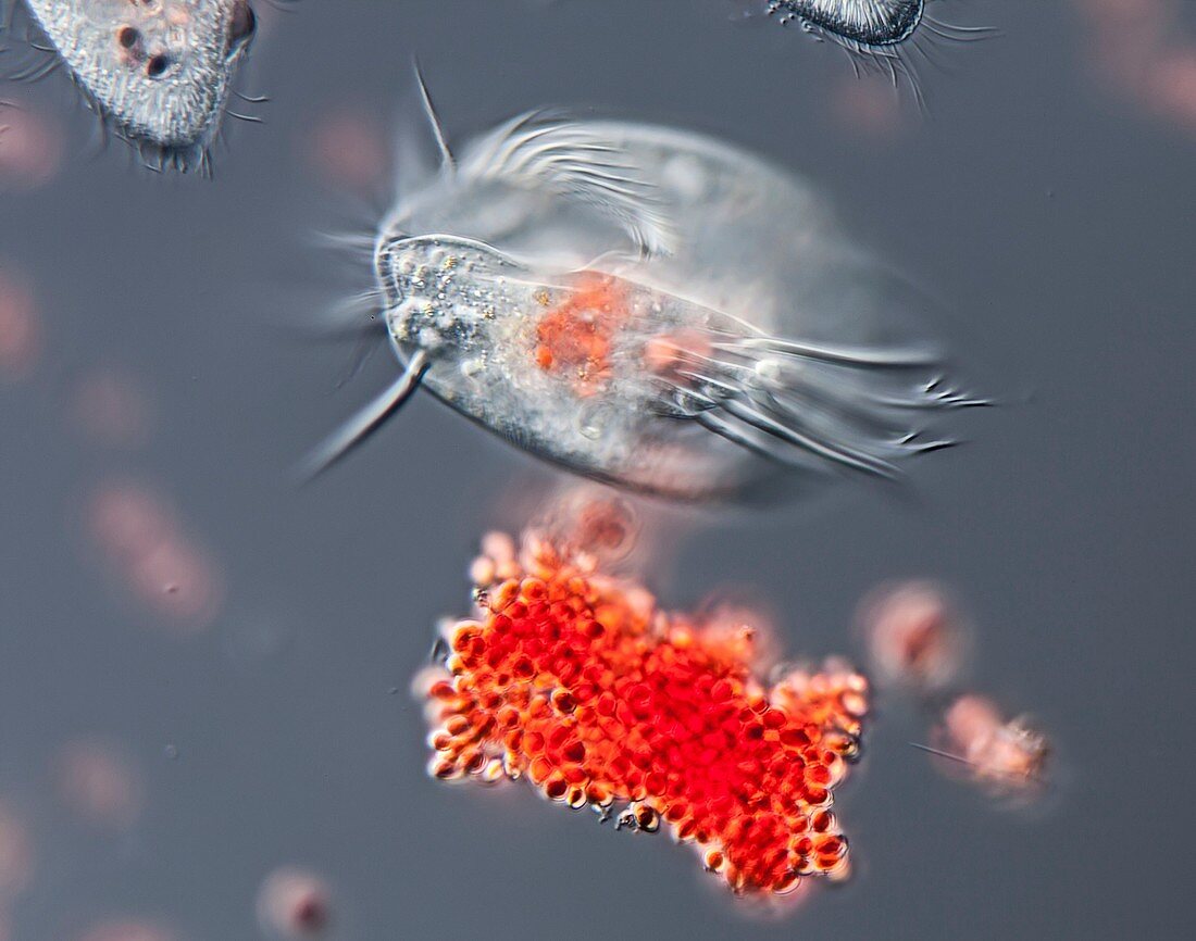 Euplotes ciliate, light micrograph