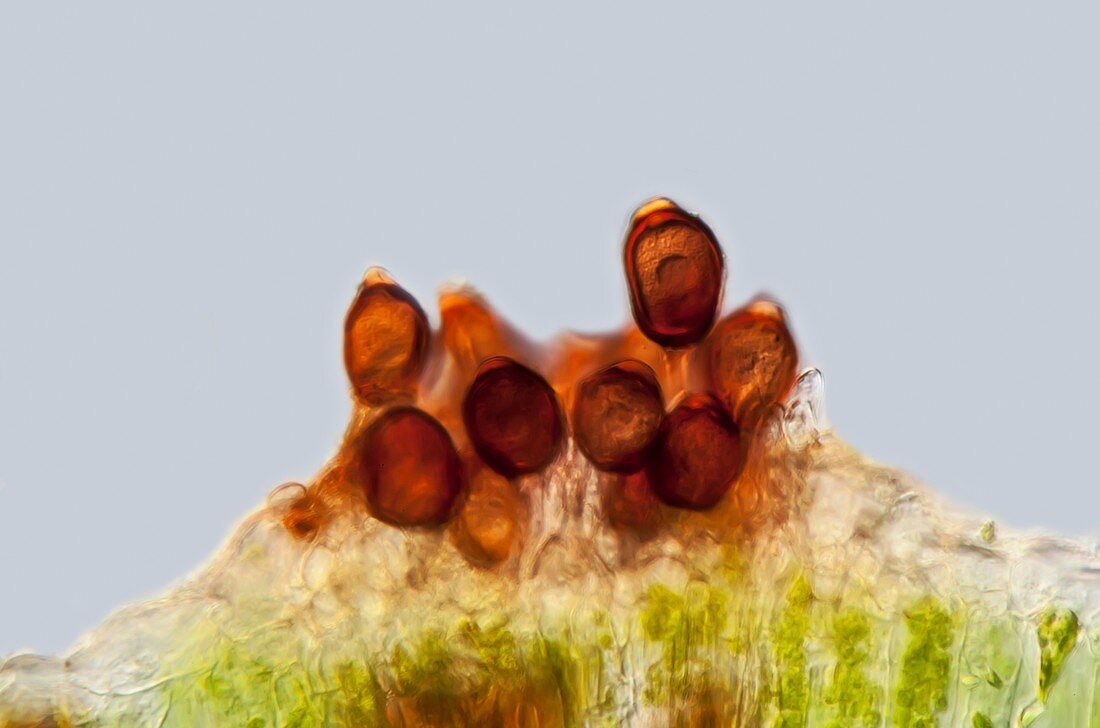 Bean rust, light micrograph