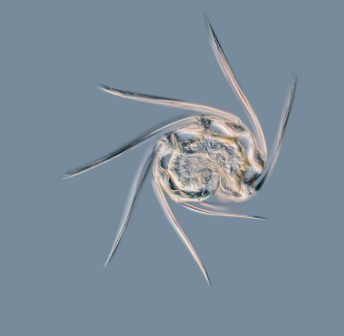 Comb jelly embryo, light micrograph