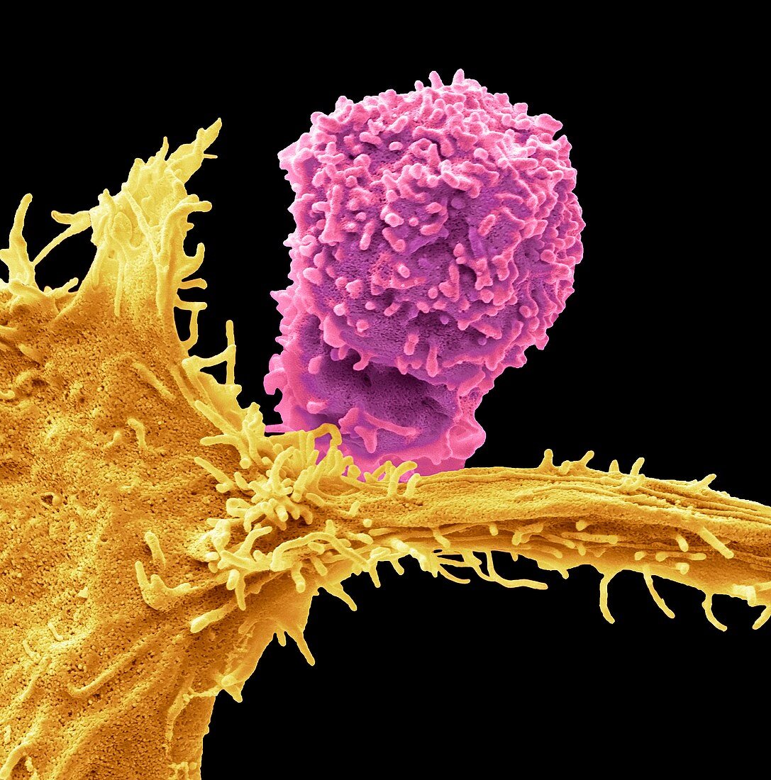 Natural killercell and cancer cell, SEM