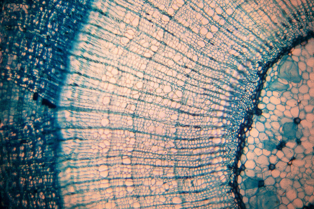 Plant tissue, light micrograph