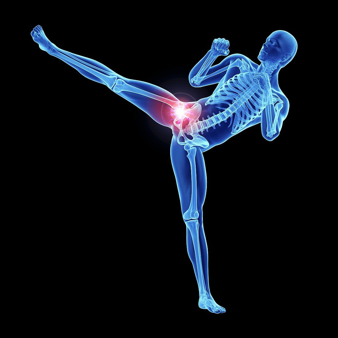 Illustration of an athlete's painful hip joint