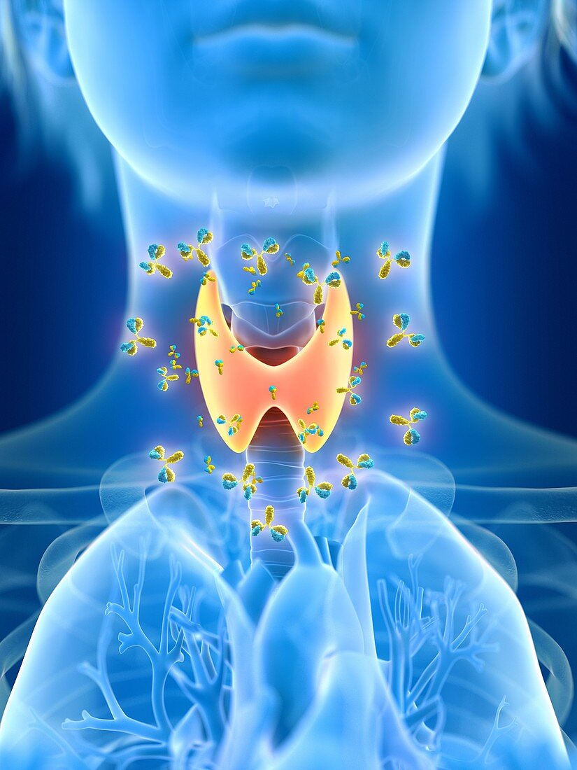 Illustration of thyroid gland being attacked by antibodies