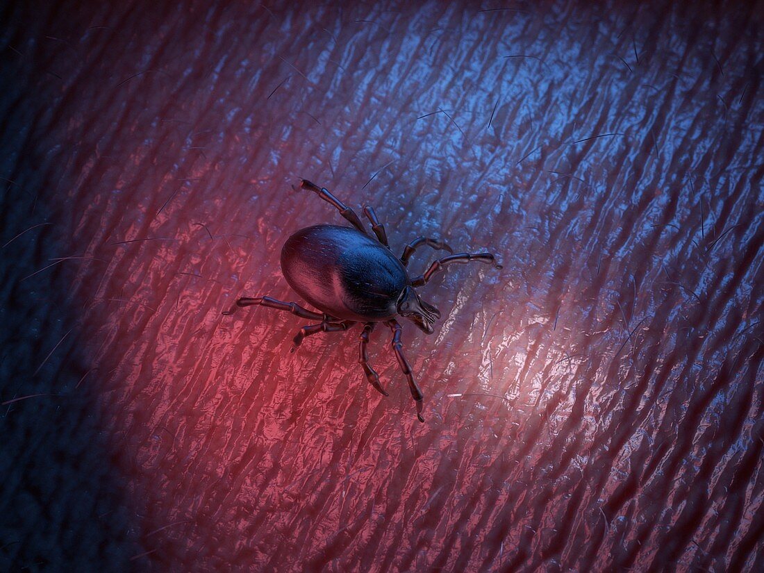 Illustration of a tick on skin