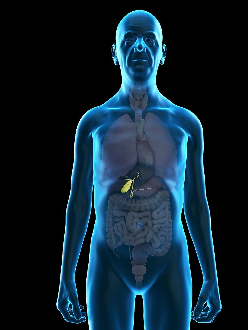 Illustration of an old man's gallbladder