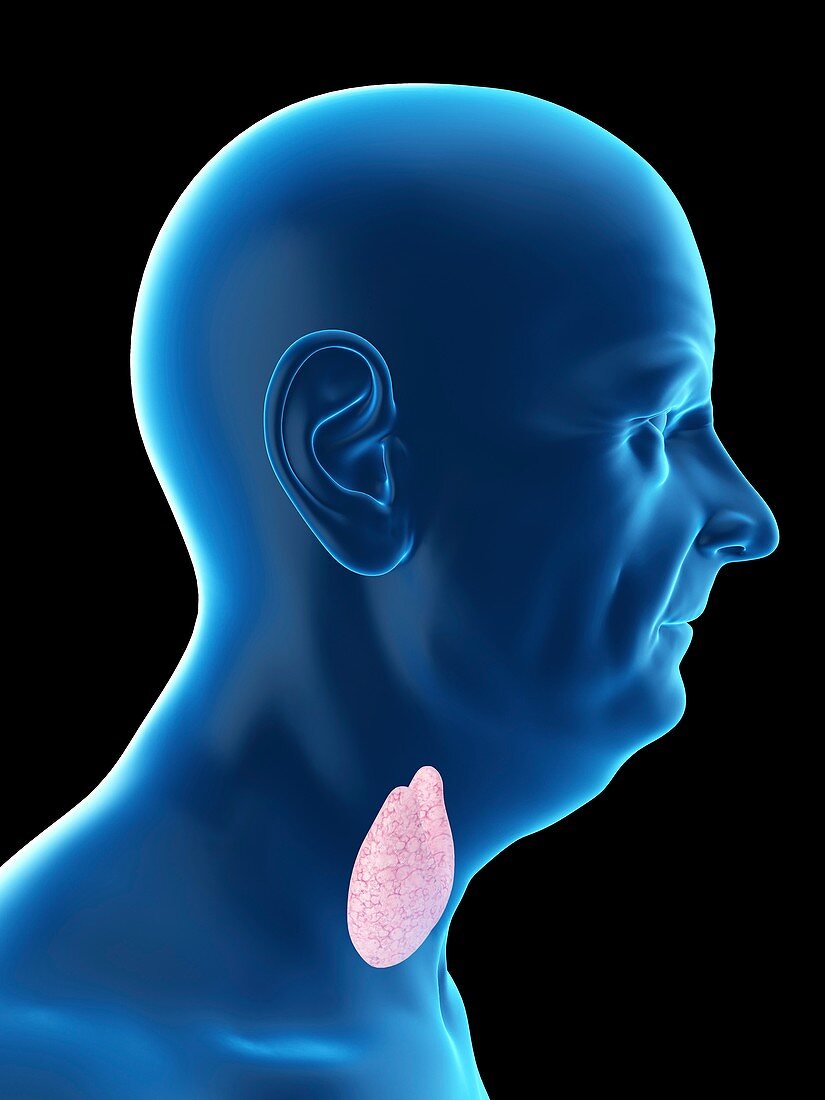 Illustration of an old man's thyroid