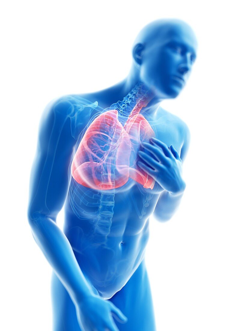 Illustration of a man with an inflamed lung
