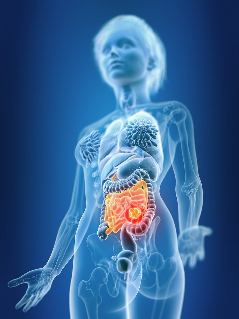 Illustration of female small intestine