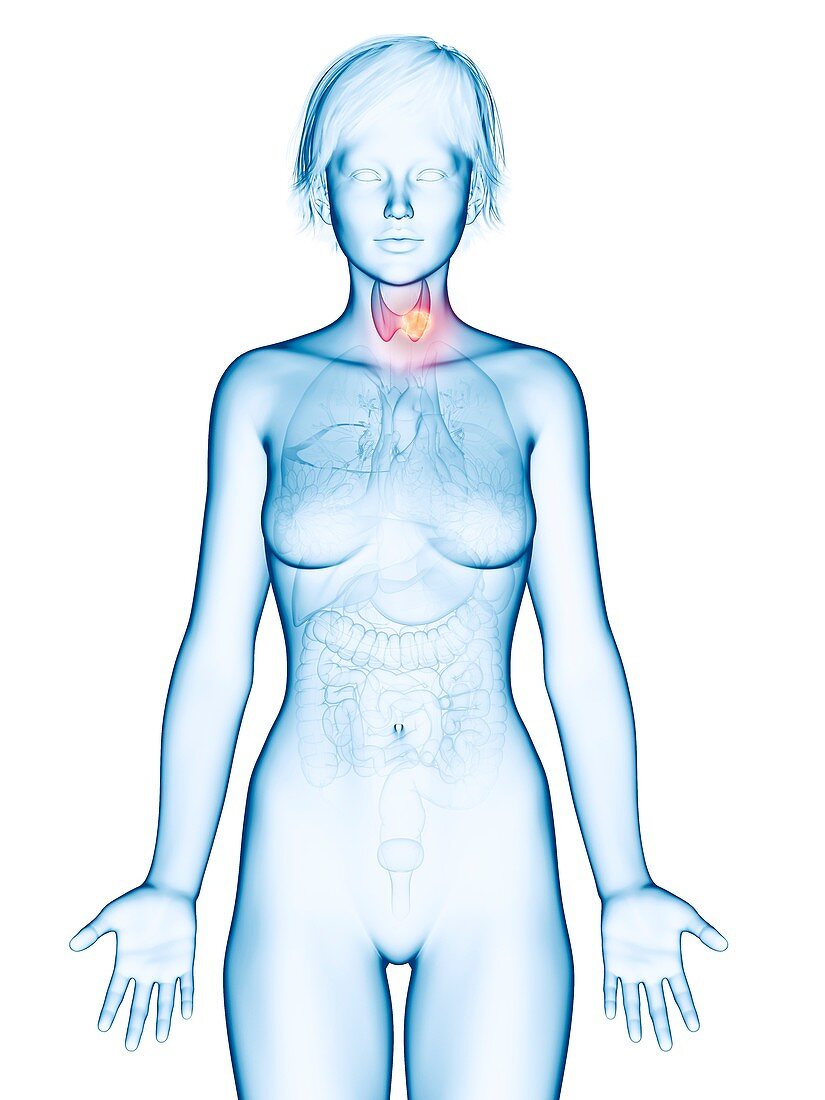 Illustration of thyroid gland cancer