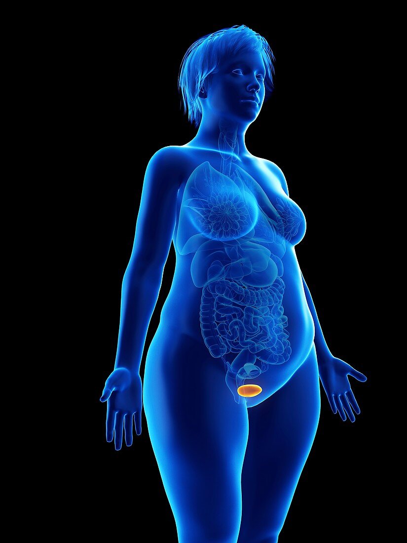 Illustration of an obese woman's bladder