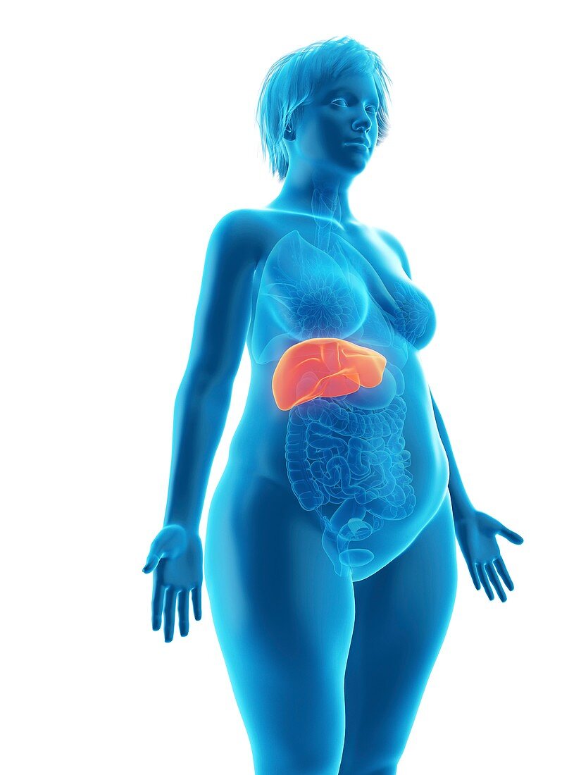 Illustration of an obese woman's liver