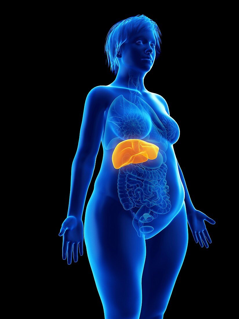 Illustration of an obese woman's liver