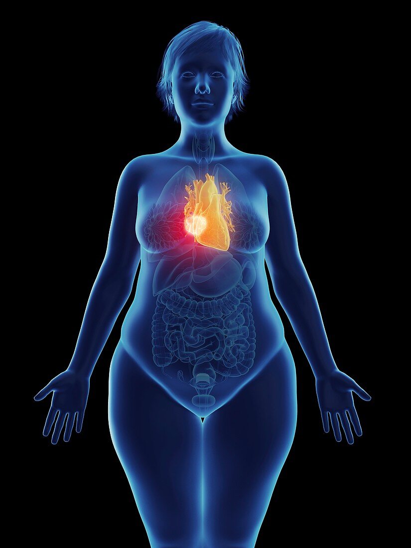 Illustration of a tumour in a woman's heart