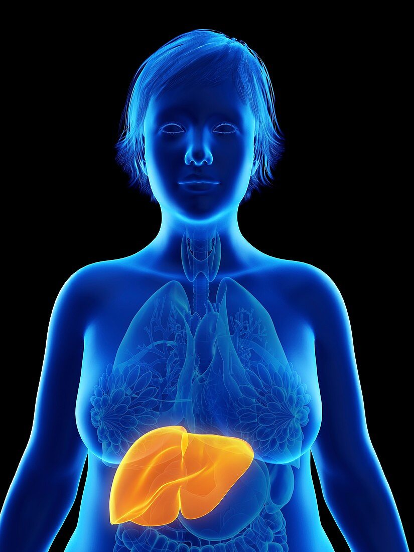 Illustration of an obese woman's liver