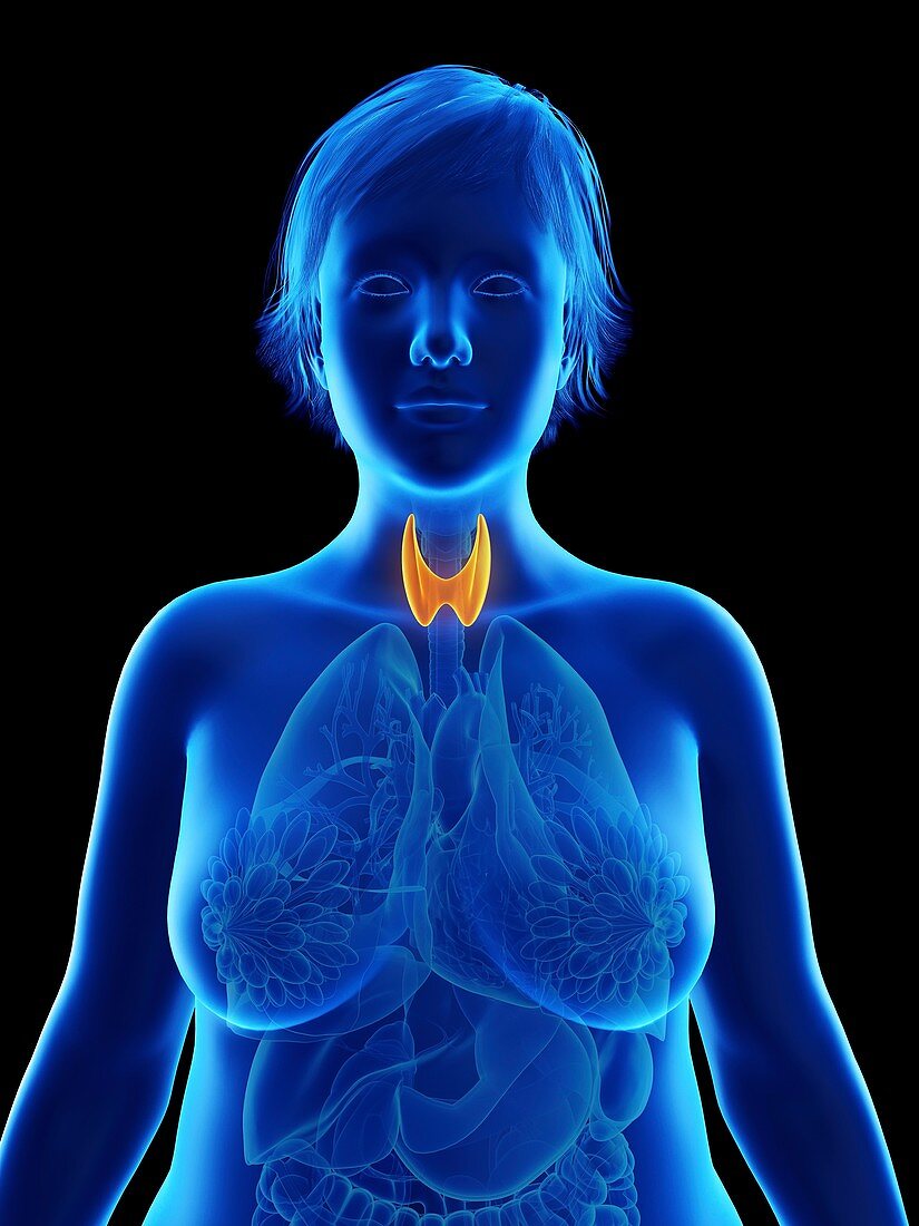 Illustration of an obese woman's thyroid gland