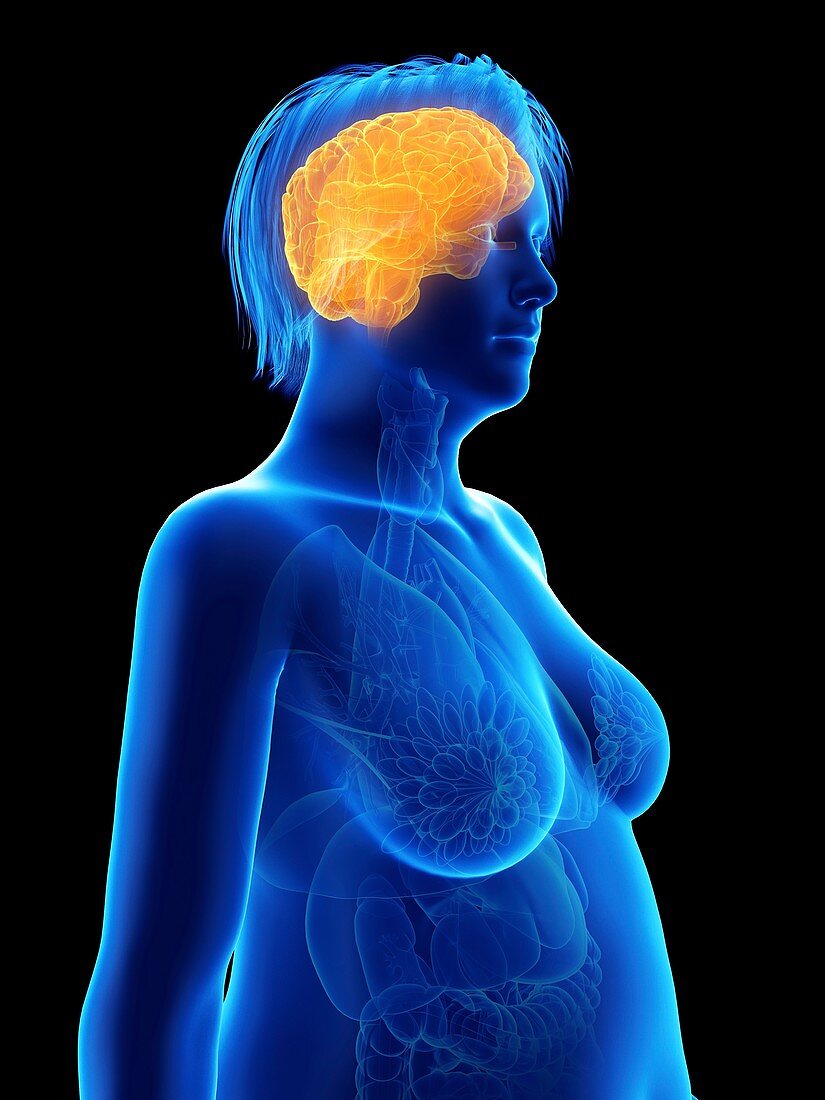 Illustration of an obese woman's brain