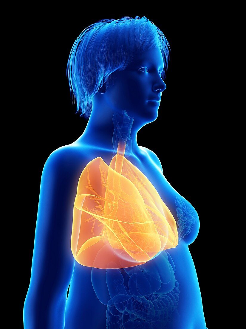 Illustration of an obese woman's lung